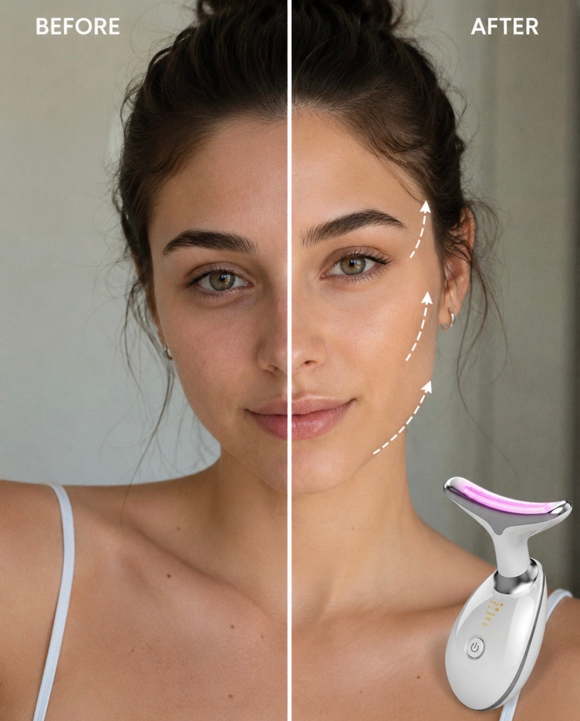 SculptLift™ Device