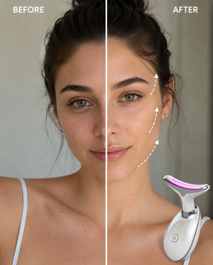 SculptLift™ Device